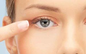 Chirurgia orbito palpebrale