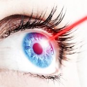 cataratta laser a fetmosecondi